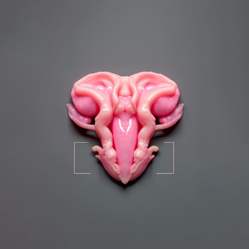 Specimen 199400004