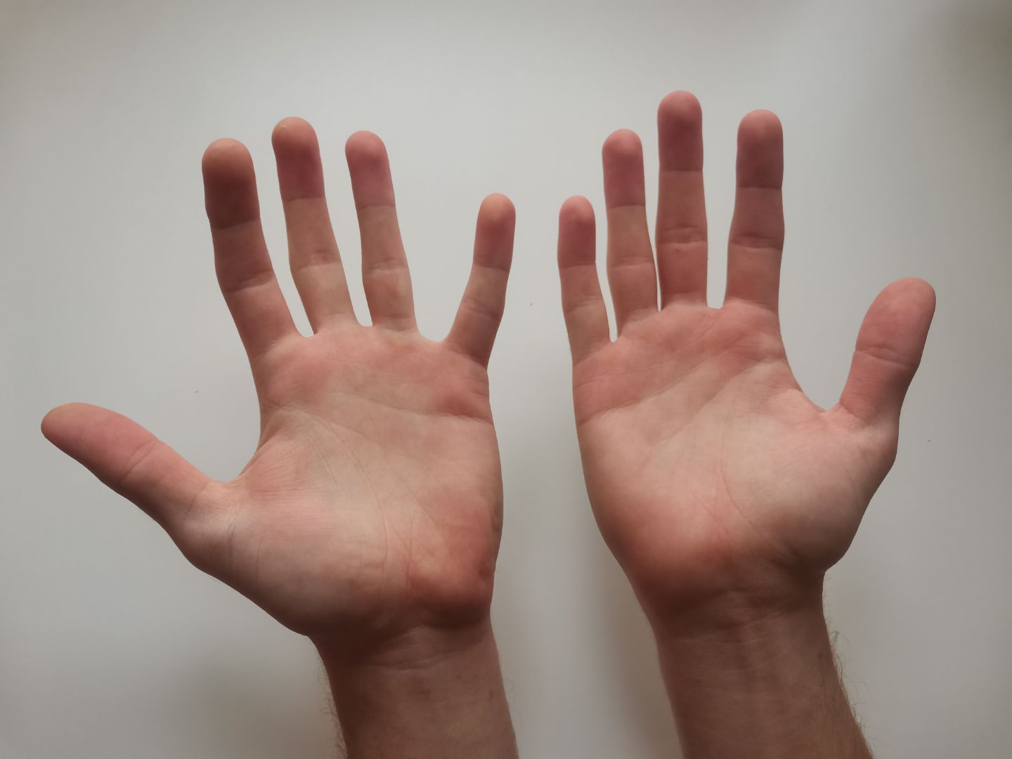 Raširene ruke kako bi se dezinfekcijsko sredstvo za ruke što prije posušilo
