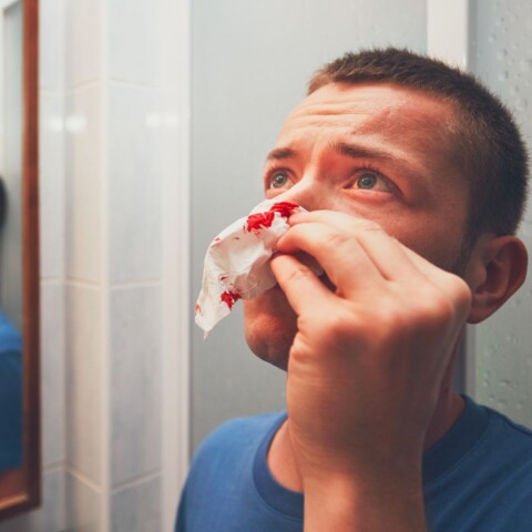 Kako zaustaviti krvarenje nosa