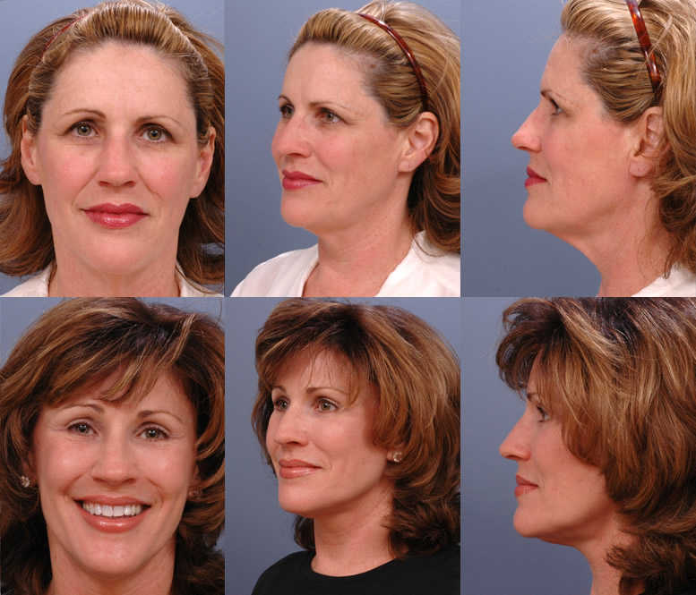 cosmetic surgery florida