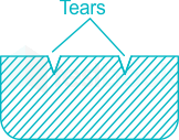 Match the casting defects (Group A) with the probable causes (Gro