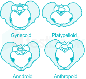types of pelvis