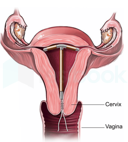 UTERUS