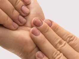 What Causes Hangnails & How Do I Prevent Them From Happening In The First Place?