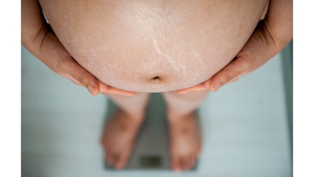 Pregnancy Stretch Marks: 5 Ways To Reduce Their Appearance During & After Gestation