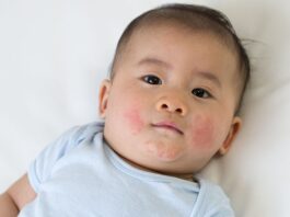 Expert Solutions For Newborn Skin Rashes And Irritations