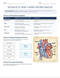 Optimizing M-Mode Line Placement for Cardiology