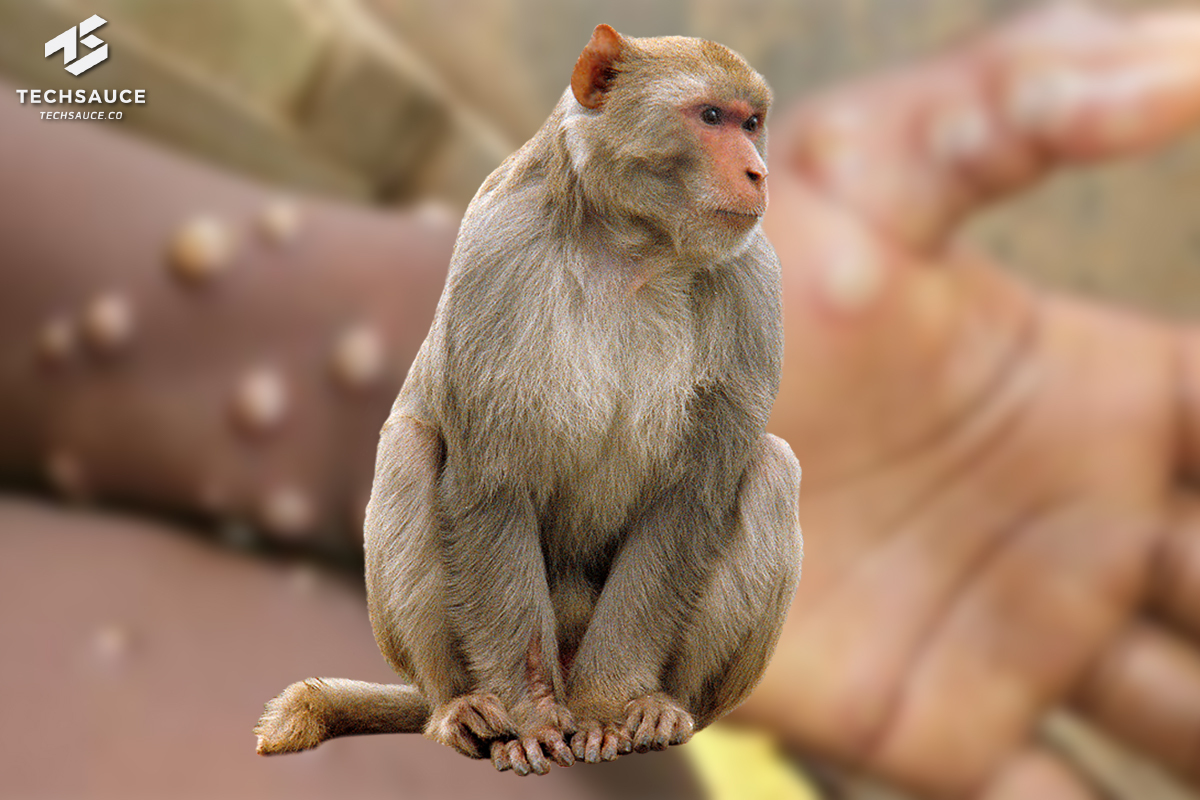 ฝีดาษลิง monkeypox