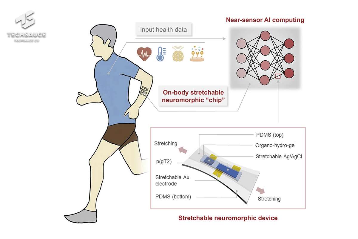 นวัตกรรมแผ่นชิปยืดหยุ่นได้  เตือนความเสี่ยงโรค พร้อมรายงาน Health Data แบบเรียลไทม์ ด้วย AI 