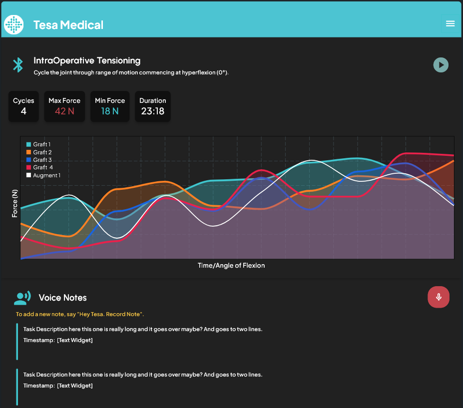 Intraoperative tensioning view showing live graft force data, cycle count, and voice notes