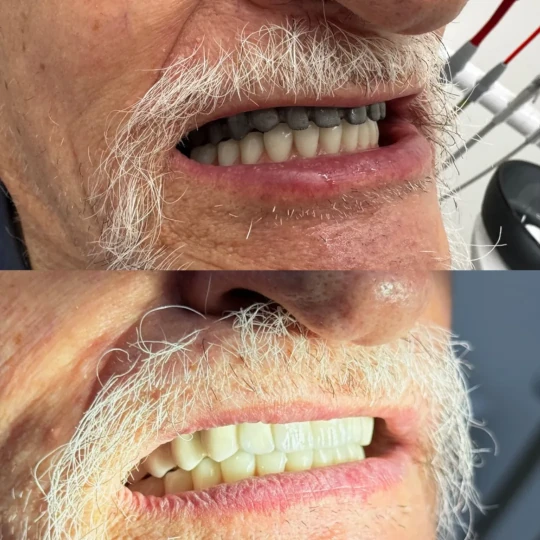 Páciensünk átalakulása 1