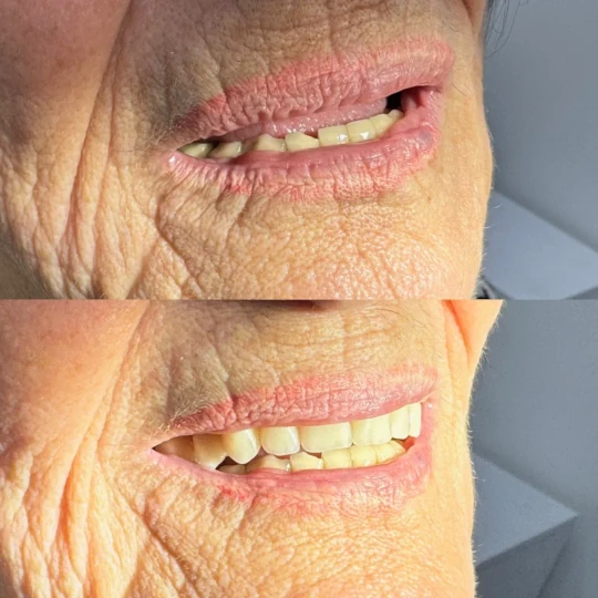 Páciensünk átalakulása 2