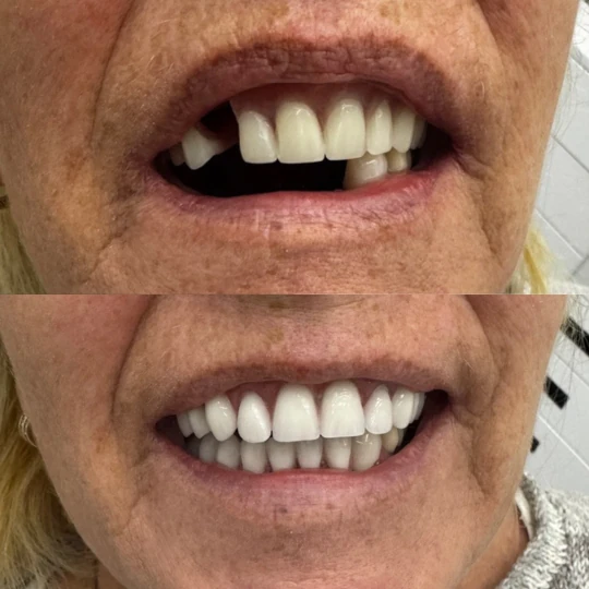 Páciensünk átalakulása 3