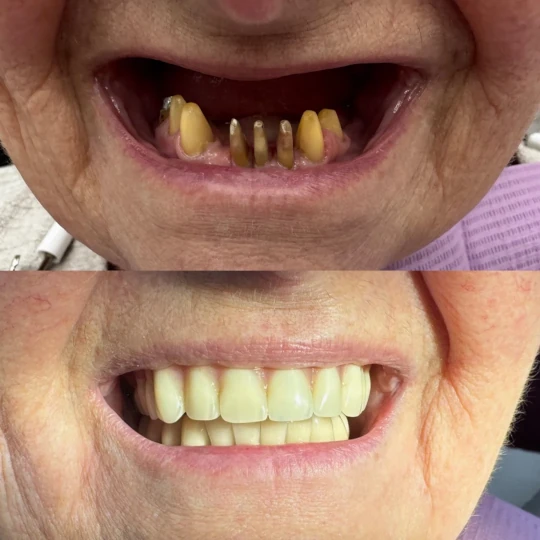 Páciensünk átalakulása 4