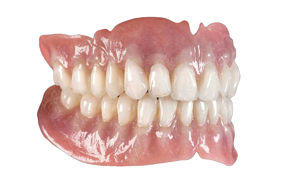 All-on-4 Procedure