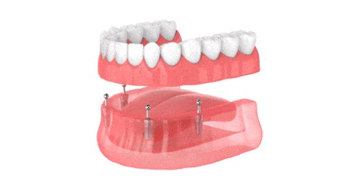 discount image