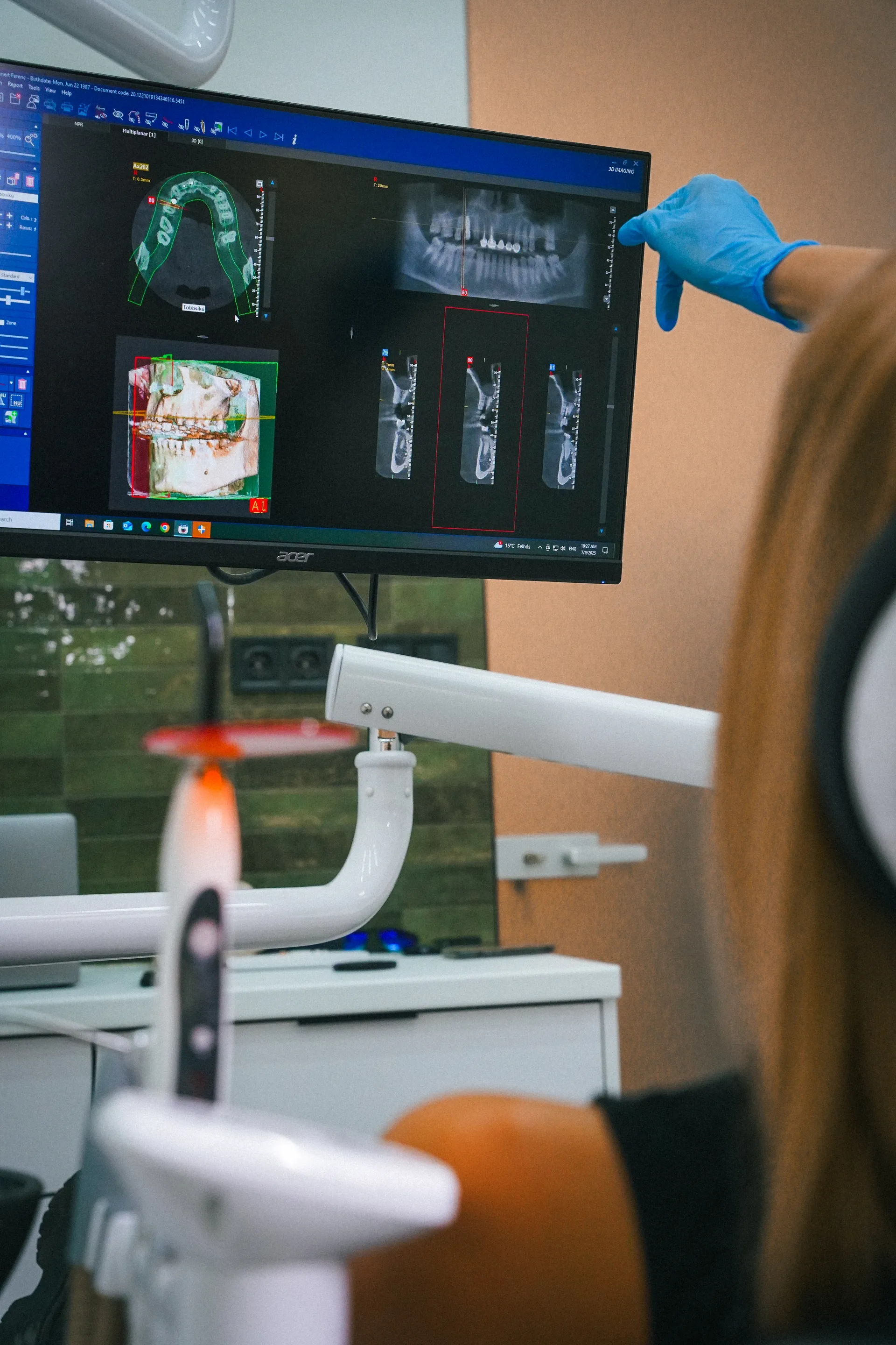 3D Scanning Machines