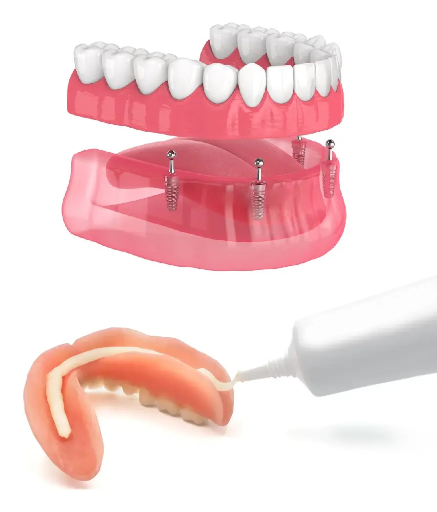 Comparison between dentures