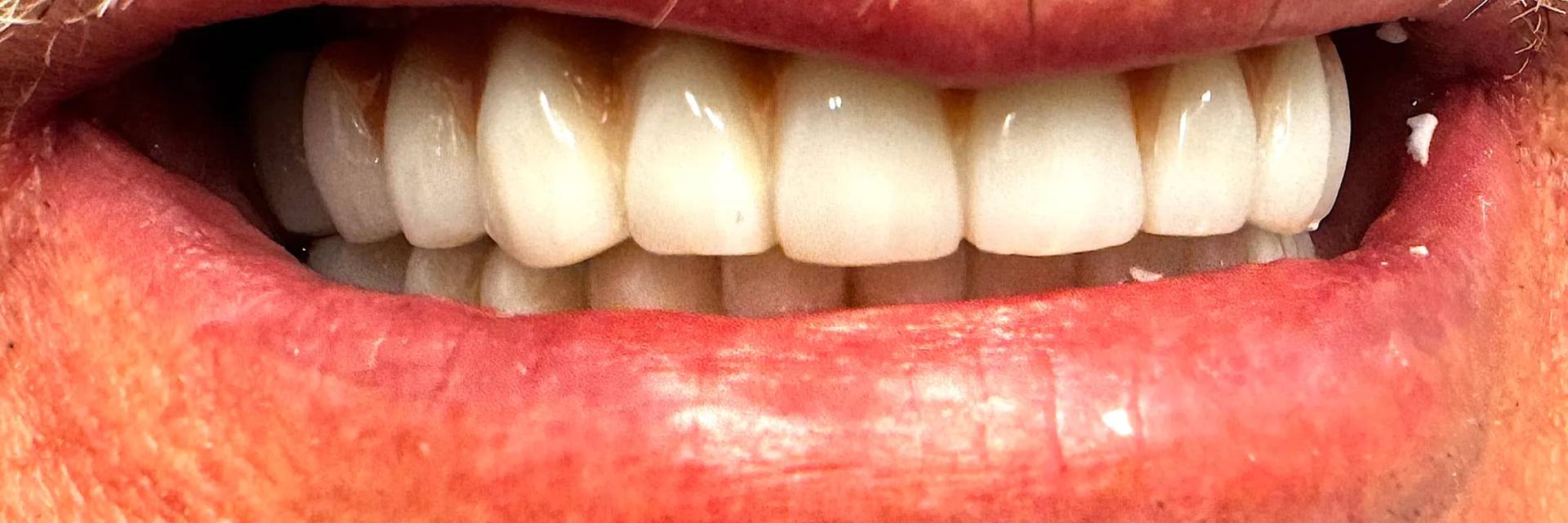 After