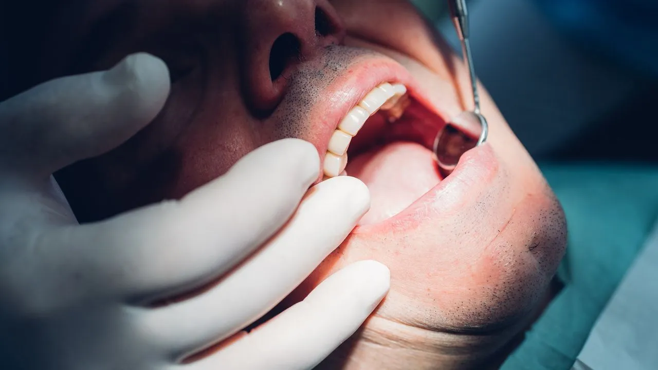 Porphyromonas gingivalis was 30x higher in calcified valves, mouse tests show it drives CAVD