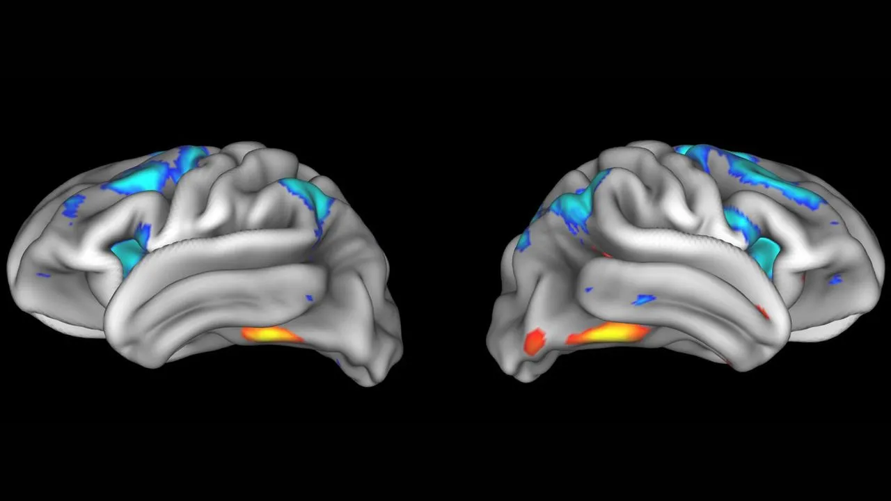 Brain imaging papers fail to replicate: thin evidence threatens neuroscience and disease progress