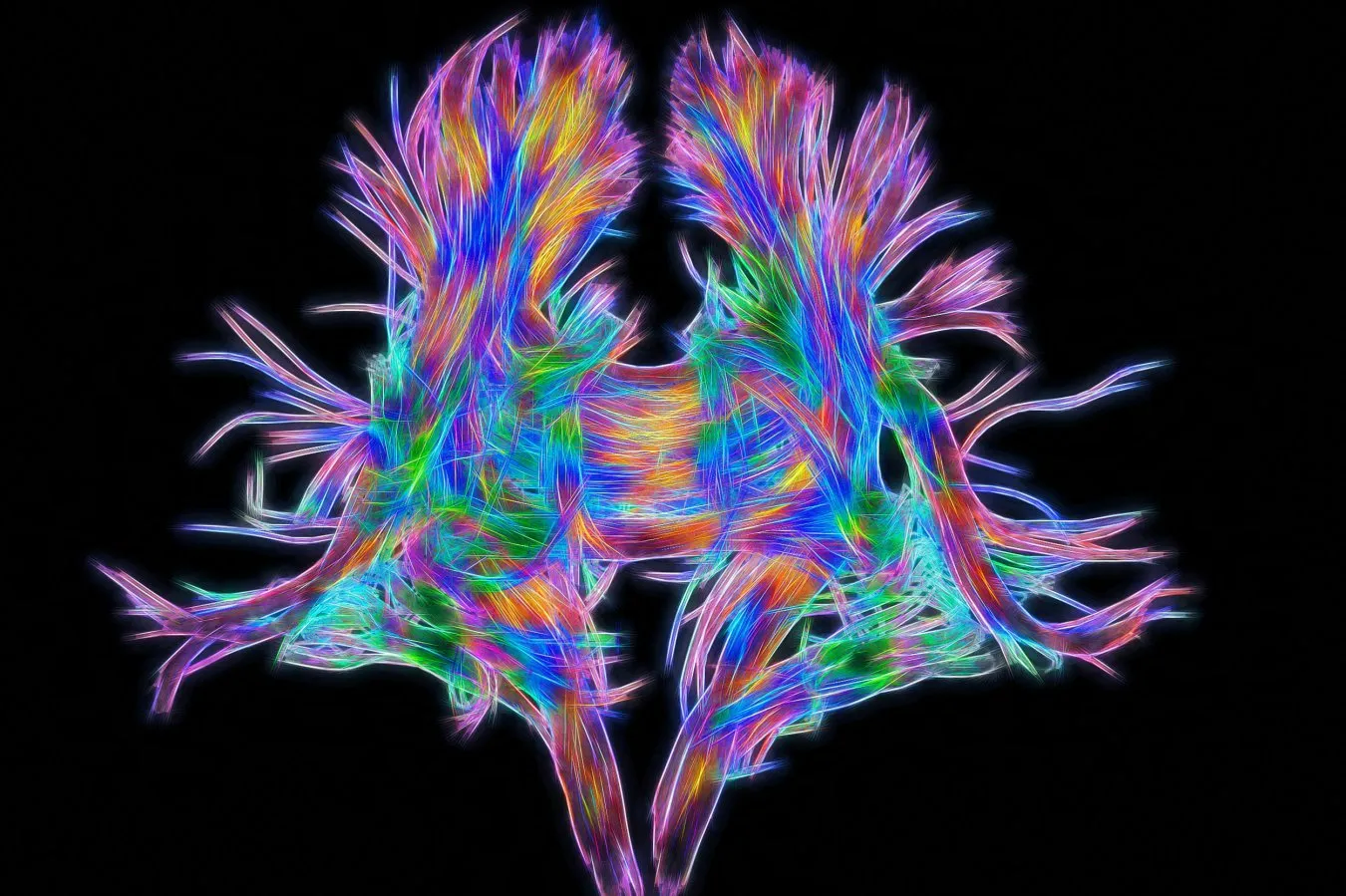 Mouse study suggests most neurons are generalists, not specialists
