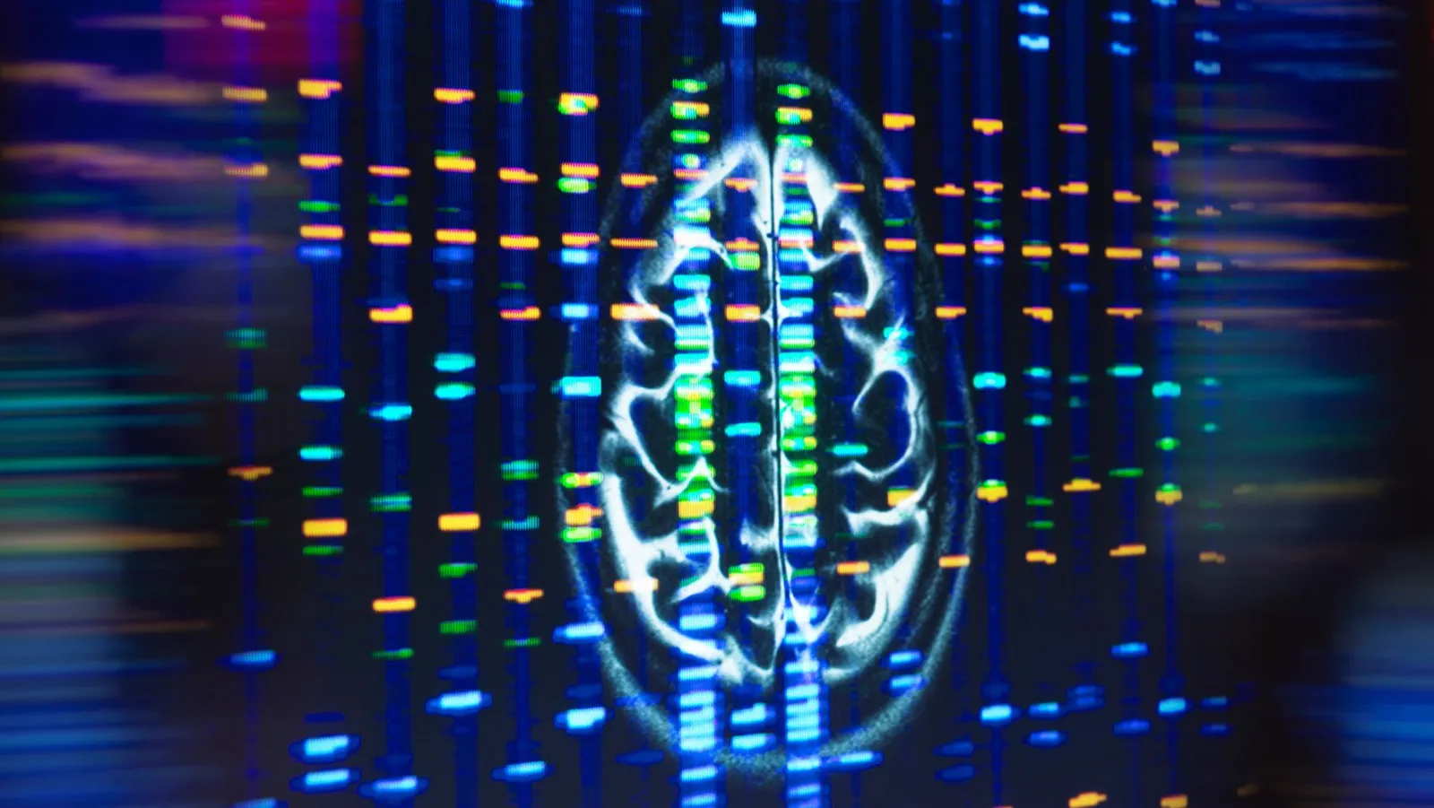 APOE4 triples Alzheimer's risk. New study finds the culprit: fat in brain cells