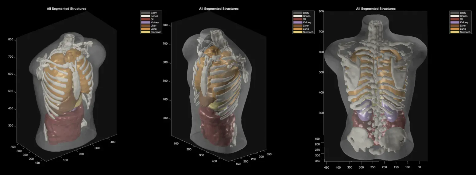 Midjourney shows a 'dunk-tank' ultrasound scanner, but proof still lags the hype