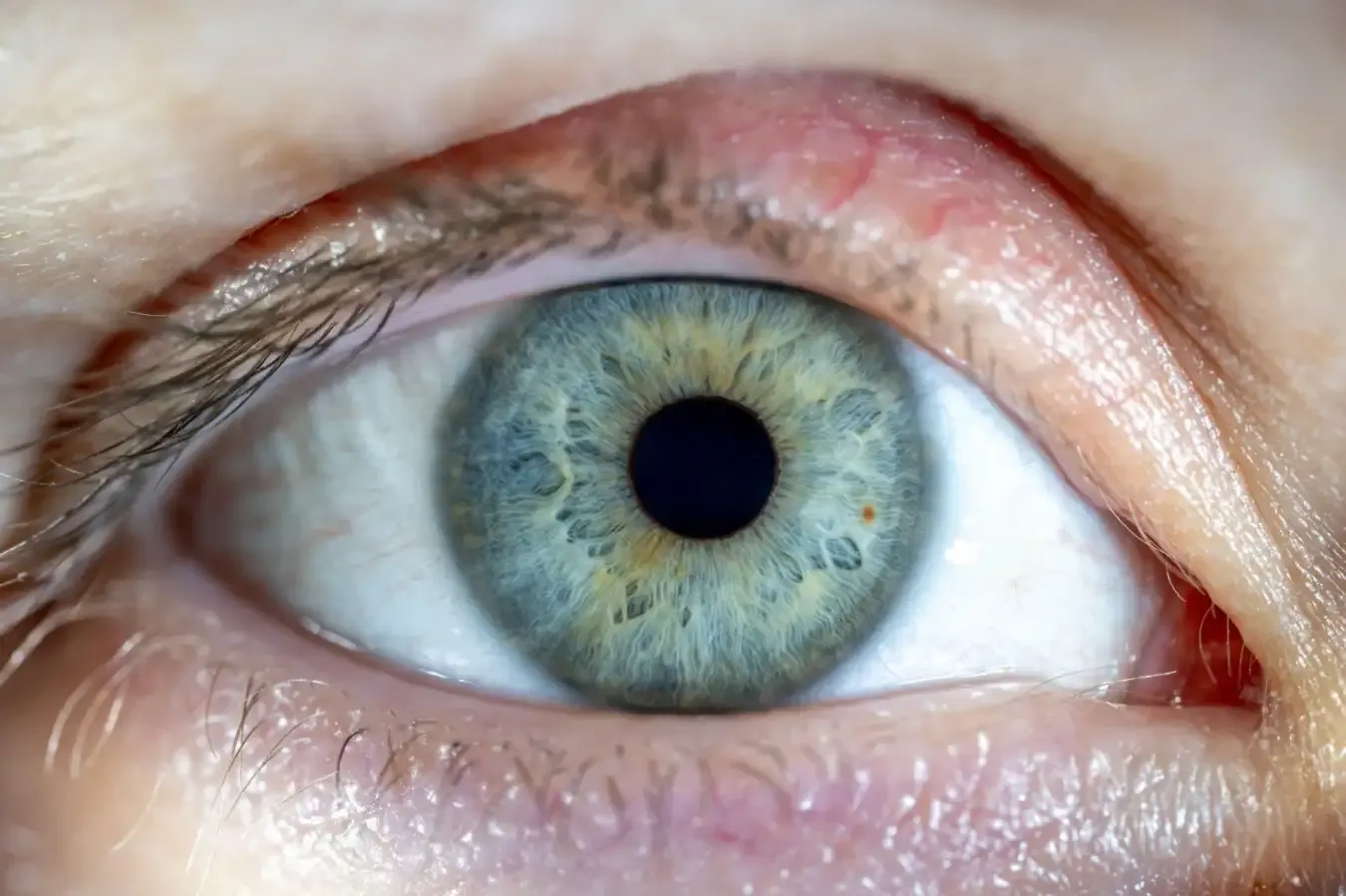 Donor human retinas still respond to light 10 hours after death under perfusion