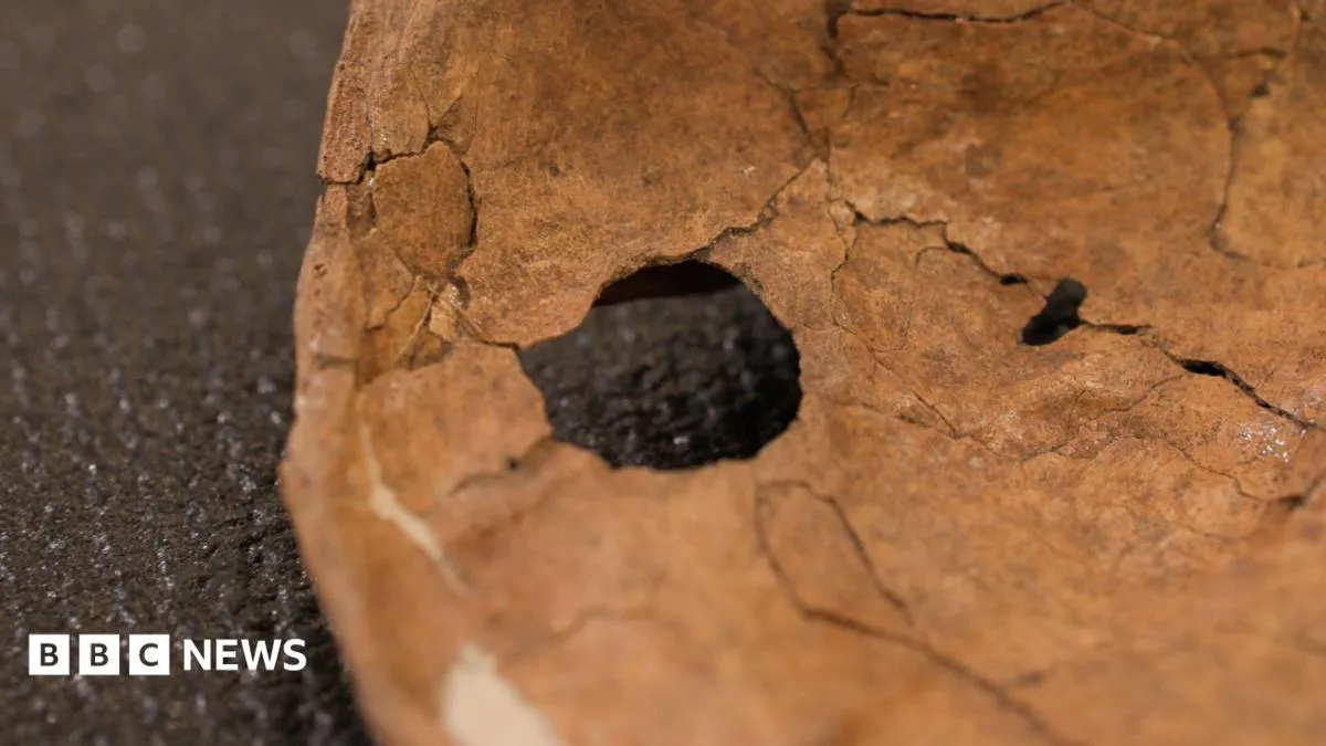 75,000-year-old Neanderthal spear wound suggests lethal fighting was common