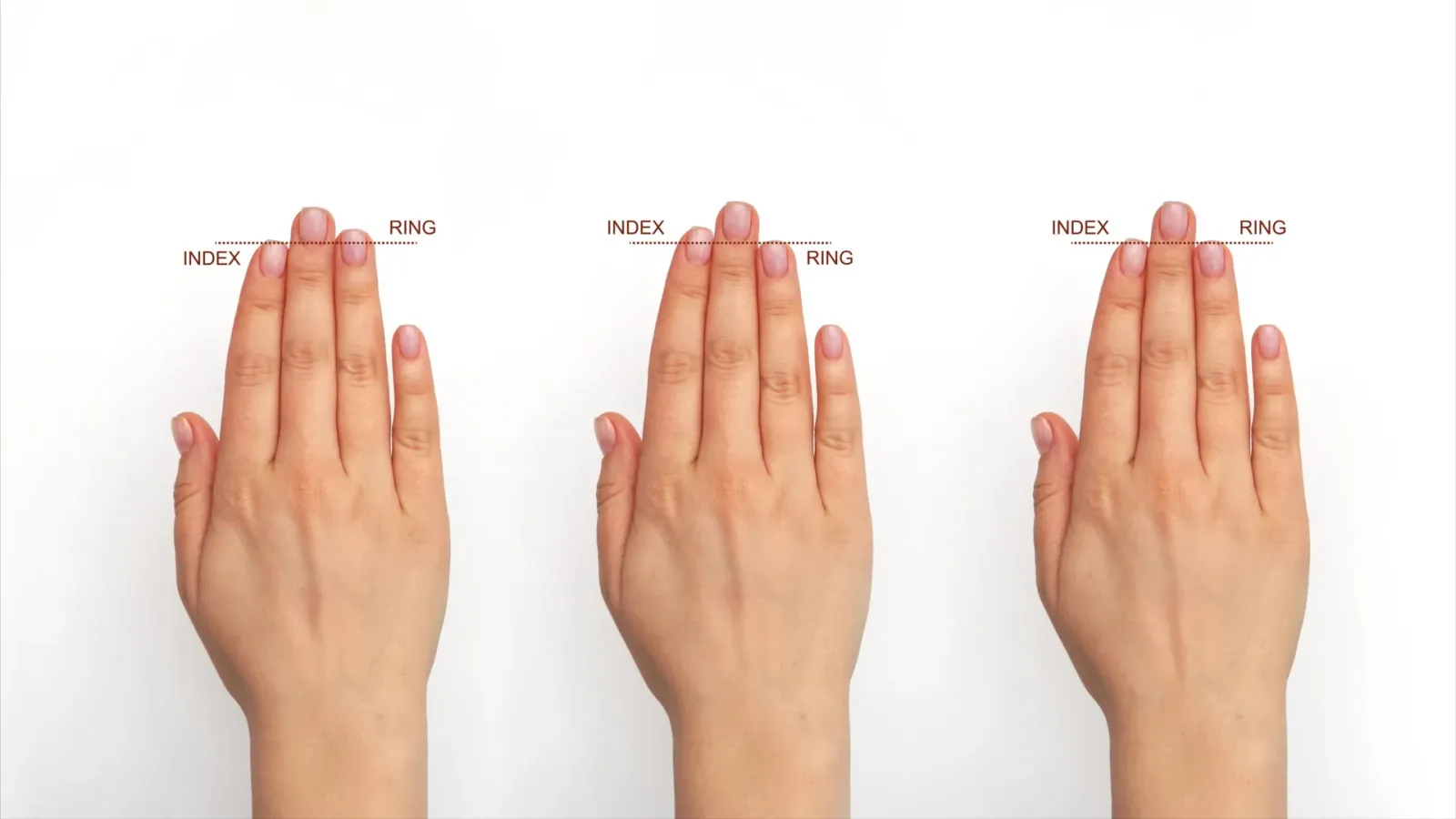 Prenatal estrogen-linked finger patterns predict larger head size in boys, not girls