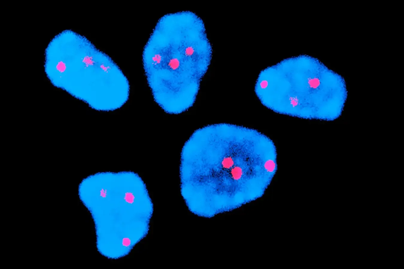 mRNA injection cuts chromosome-number errors in older human eggs with missing key protein