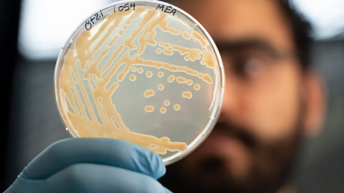 Ötzi's frozen microbes are still growing, with yeast alive in his museum body