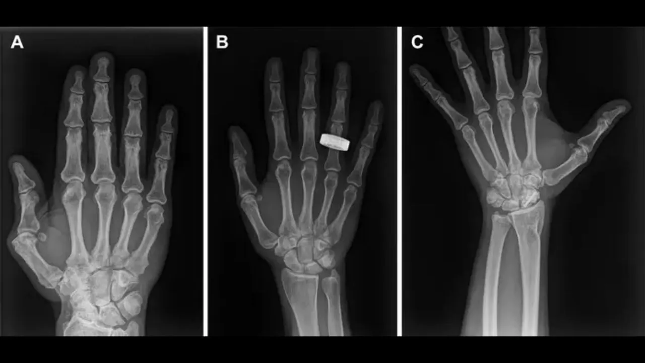 Portable X-ray hits orbit on Fram2, proving space diagnosis for broken bones and more