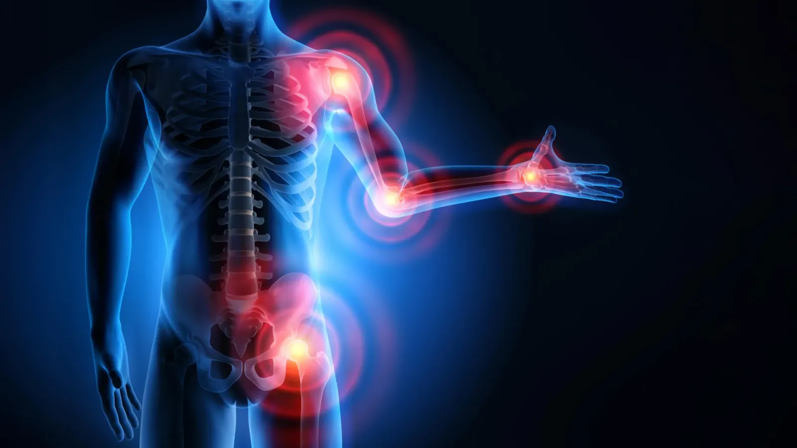 Study links statin muscle pain to an immune response, unlocking muscle-sparing drug strategies