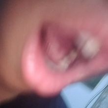 Adrick