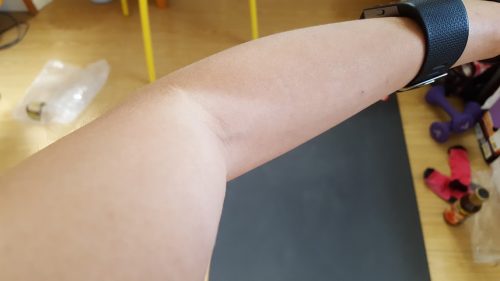 elbow tan