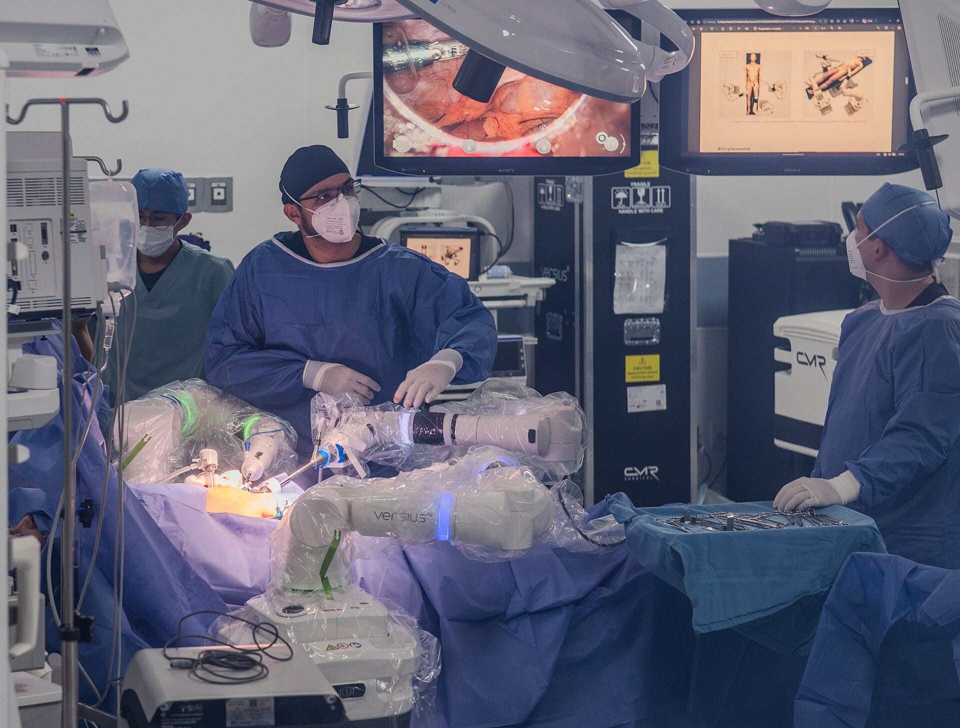 Surgeons work around the Versius robotic system during a cholecystectomy at IMSS Bienestar Xoco hospital in Mexico City