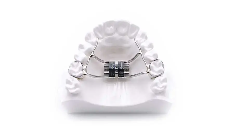 The Look Orthodontists - RME (Rapid Maxillary Expander)