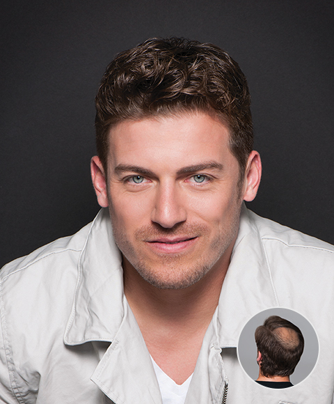 Exclusively His Hair Salon - Hair Replacement Services Exclusively His Hair Salon - Hair Replacement Services