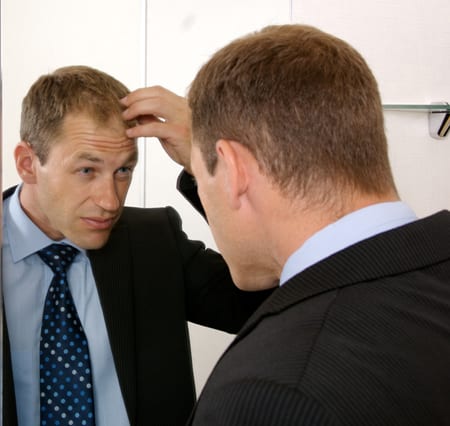 Male Pattern Baldness