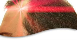 Laser Hair Therapy