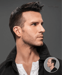 Men’s Hair Replacement Men's Hair Replacement