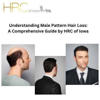 Understanding Male Pattern Hair Loss: A Comprehensive Guide by HRC of Iowa