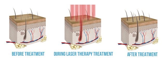 Benefits of Light Therapy On Chronic Pain - Advanced Musculoskeletal  Medicine Consultants, Inc.