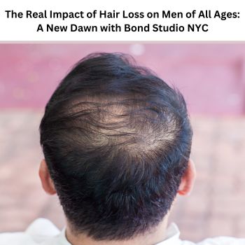 The Real Impact of Hair Loss on Men of All Ages: A New Dawn with Bond Studio NYC