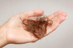 Clump of hair in hand