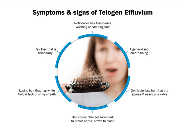 telogen effluvium