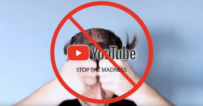 Stop The Madness - How-To Non-Surgical Hair Replacement