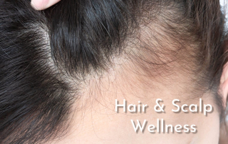 Hair and Scalp Wellness